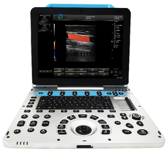 EUR VET High-Quality Veterinary Ultrasound Color Doppler Ultrasound System Size 15 Inch Monitor Veterinary Equipment