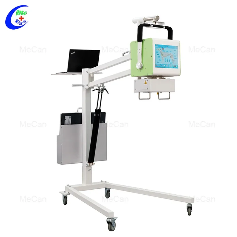 Medical equipment, digital doctoral mobile , X-ray machine