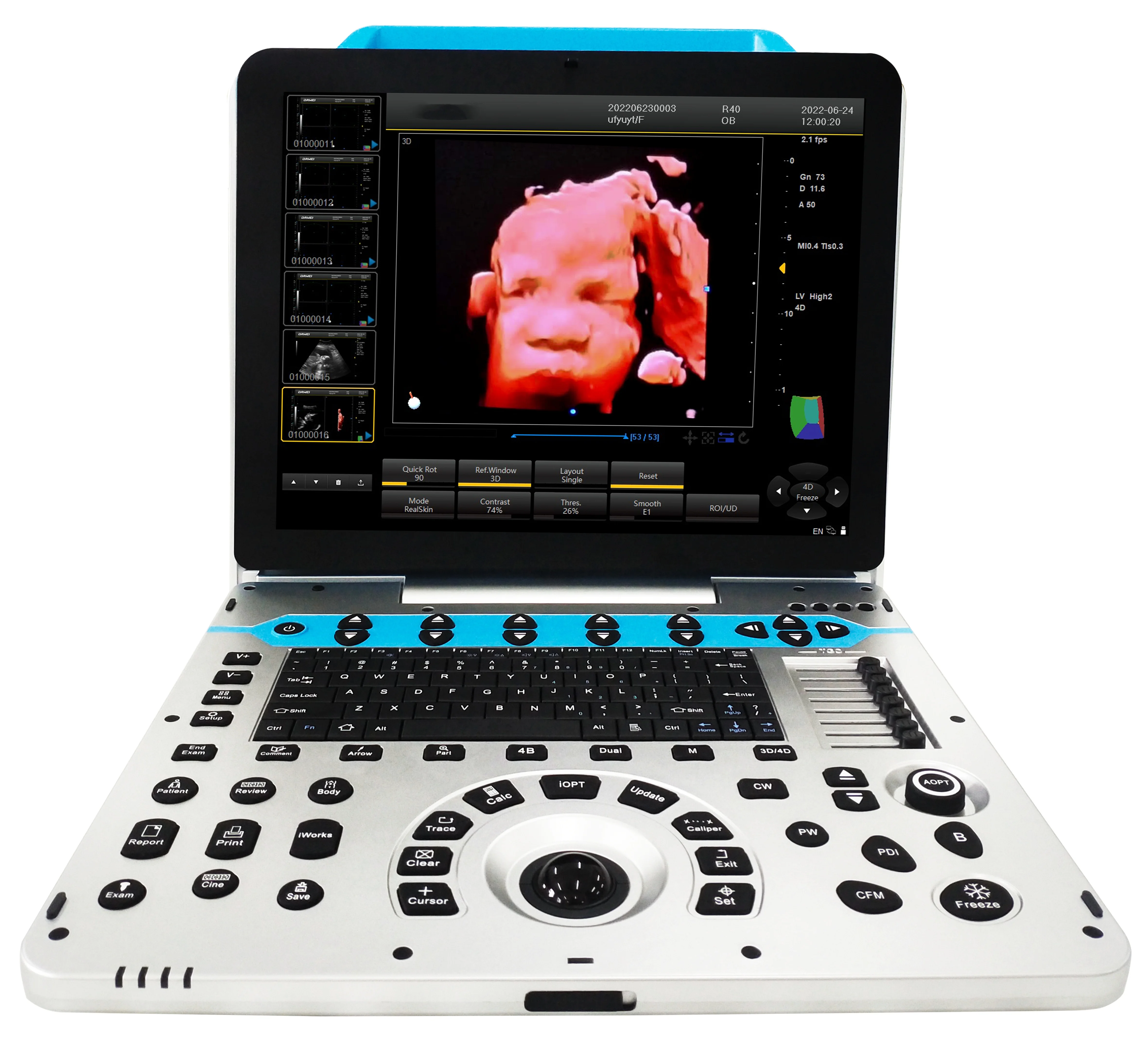 General imaging 15inch full digital screen THI laptop portable color doppler machine for sale