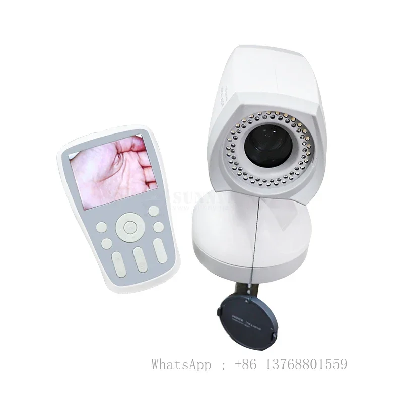 SY-F005 Cost-effective Potable Medical Digital Video Endoscope For Gynecology Examination