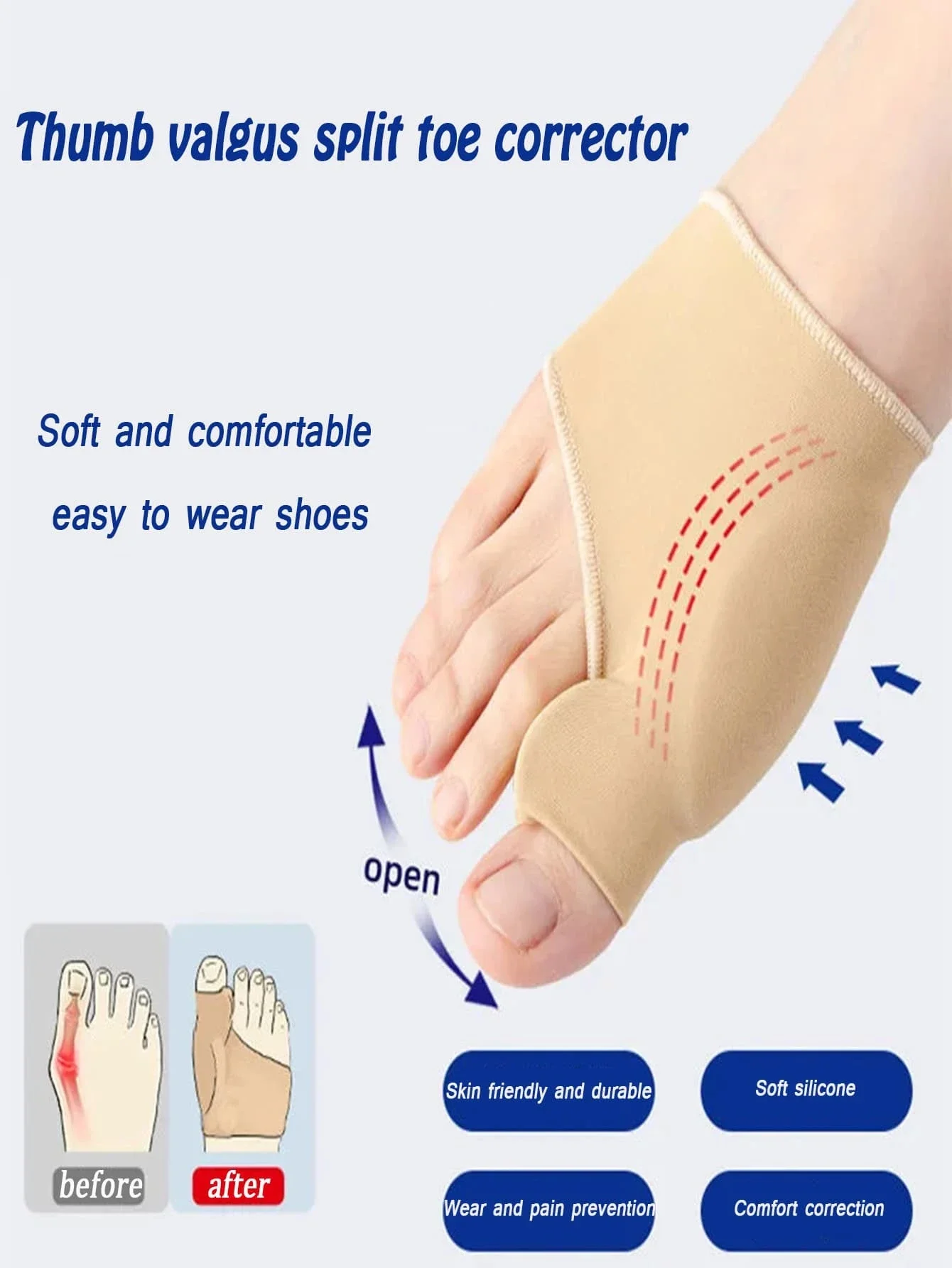 Beige Thumb Valgus Orthotics Can Be Worn Day And Night With Shoes, Elastic Bandages And Overlapping Toes