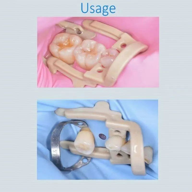 2 Pieces Dental Rubber Dam Clamps Distal Extension Resin Clamp for Endodontic Restorative Treatment Posterior Teeth Isolation