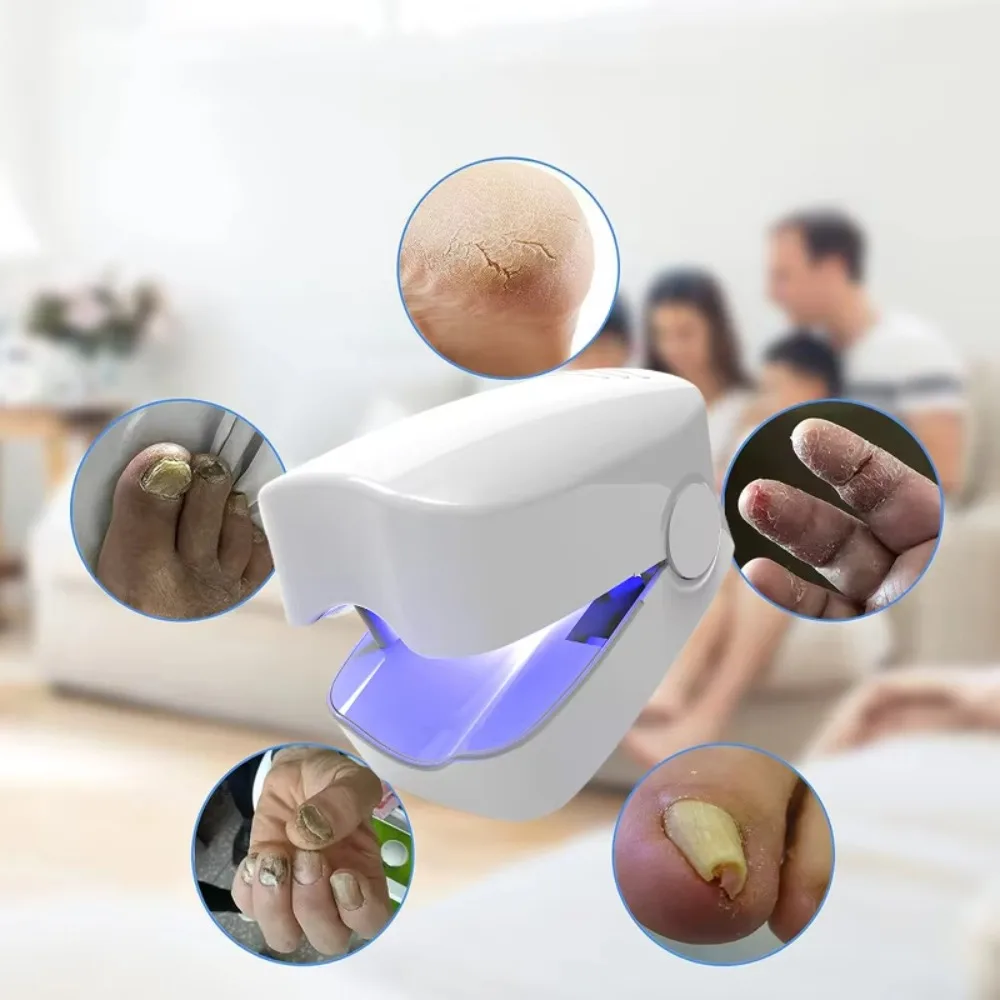 เครื่องมือช่วยรักษาเชื้อราที่เล็บ อุปกรณ์ทำความสะอาดเล็บ รักษาโรคเชื้อราที่เล็บ ชาร์จผ่าน USB ด้วยแสงเลเซอร์ LED 910nm อินฟราเรด และแสงสีฟ้า 470nm