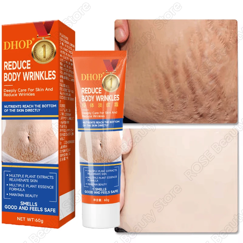 

Stretch Marks Permanent Removal Cream Maternity Pregnant Women Pregnancy Anti-Winkle Smooth Repair Firming Skin Body Skin Care