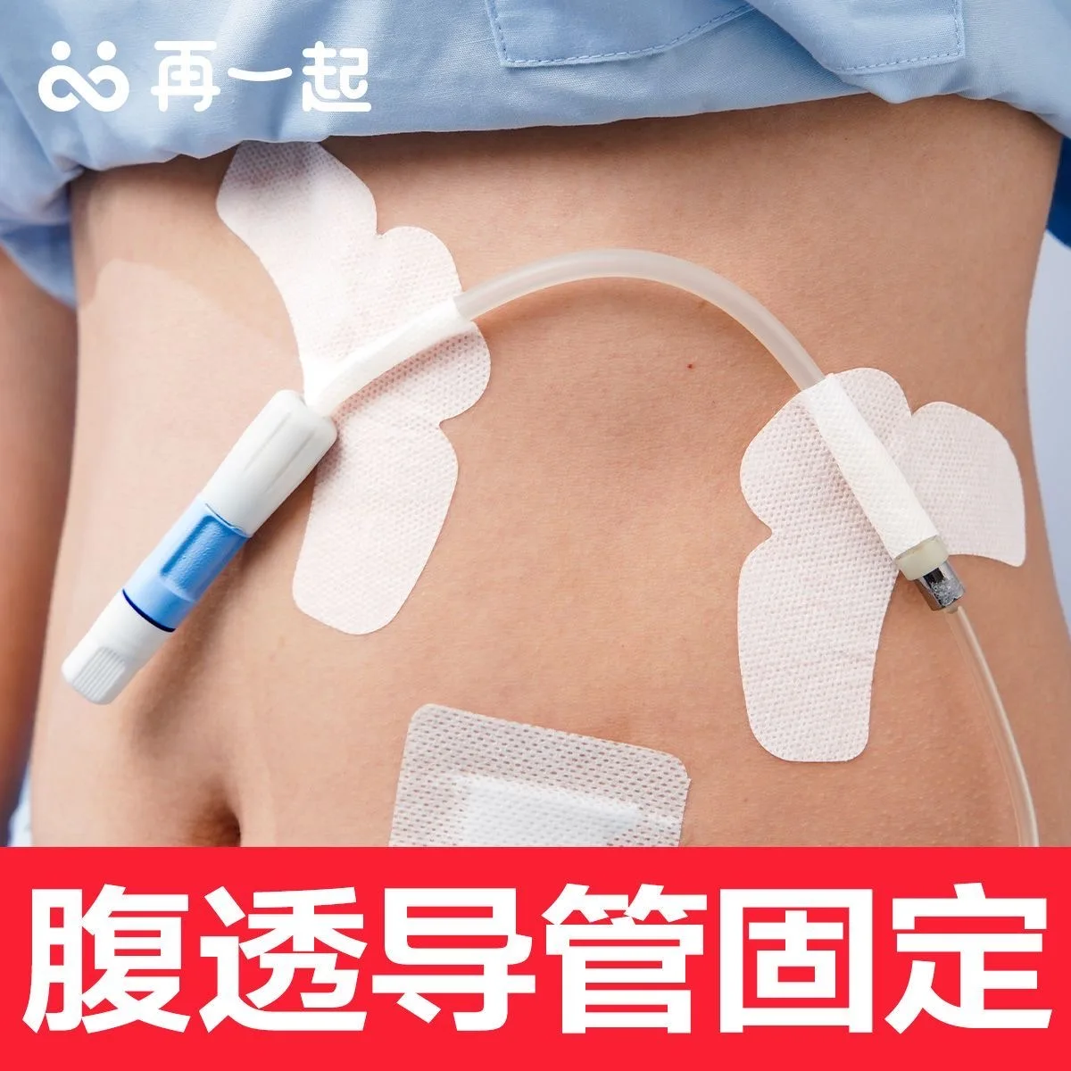 Abdominal dialysis catheter fixed with PICC catheter fixed with bile drainage tube butterfly shaped medical adhesive tape