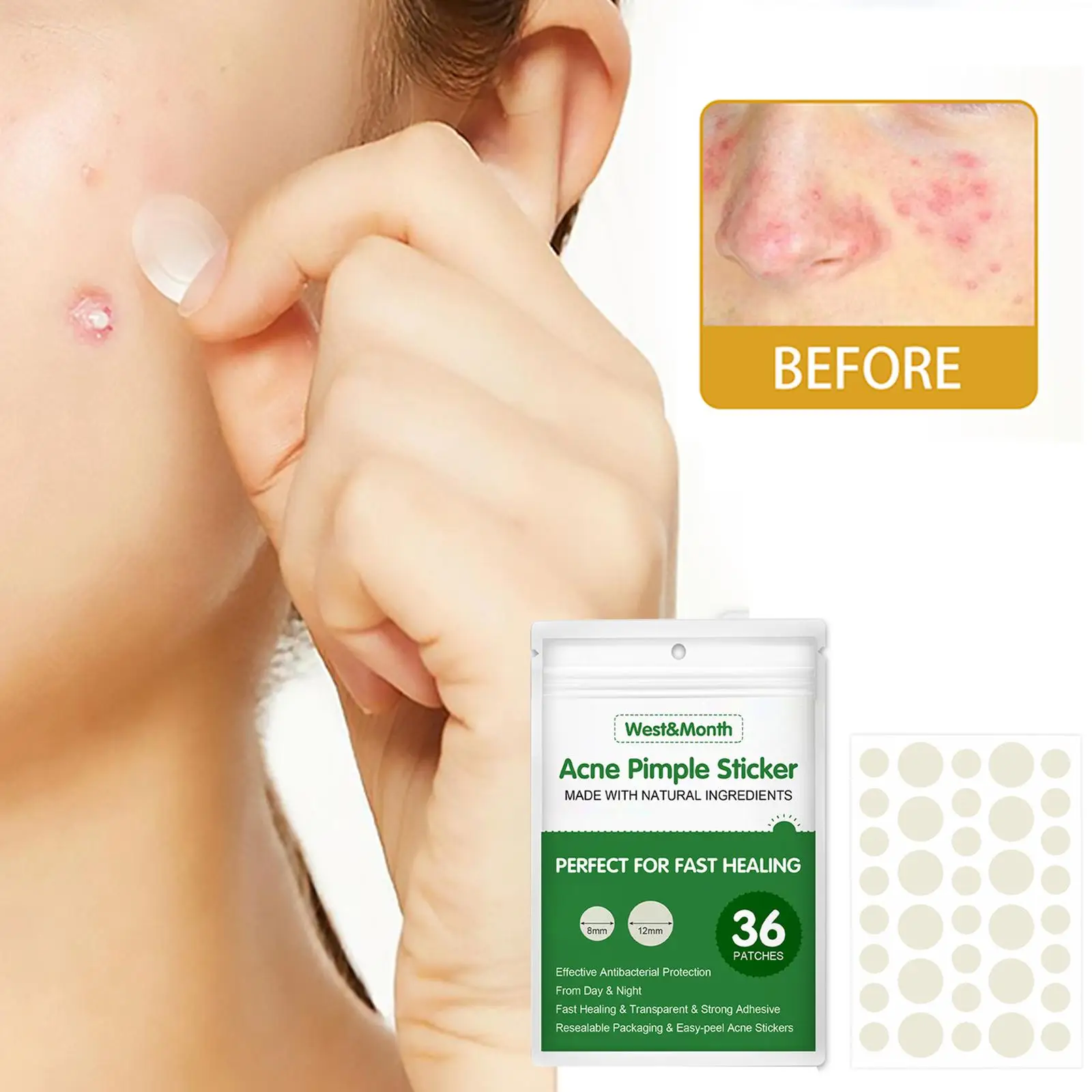 24/36Pcs Acne Pimple Patch Sticker Acne Treatment Pimple Remover Skin Facial Care Для Mask Tool Blemish Лица Spot Маска