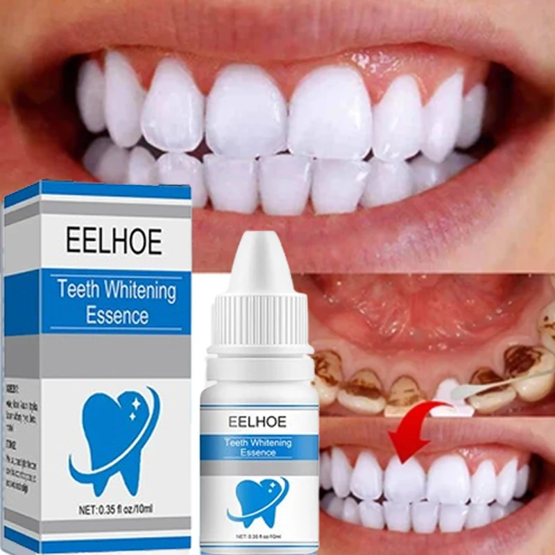 

Removing Tartar Plaque Teeth Deep Cleaning Brighten