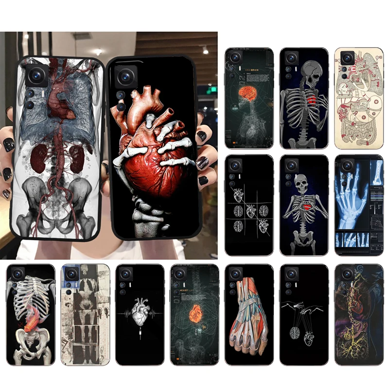 

Human Organs Skeleton Skull Brain Case for Xiaomi Mi 11T 11 12T Pro 10T 10 10Pro 12 11 lite 5G NE 12S 10pro Poco X3 Pro Poco F3