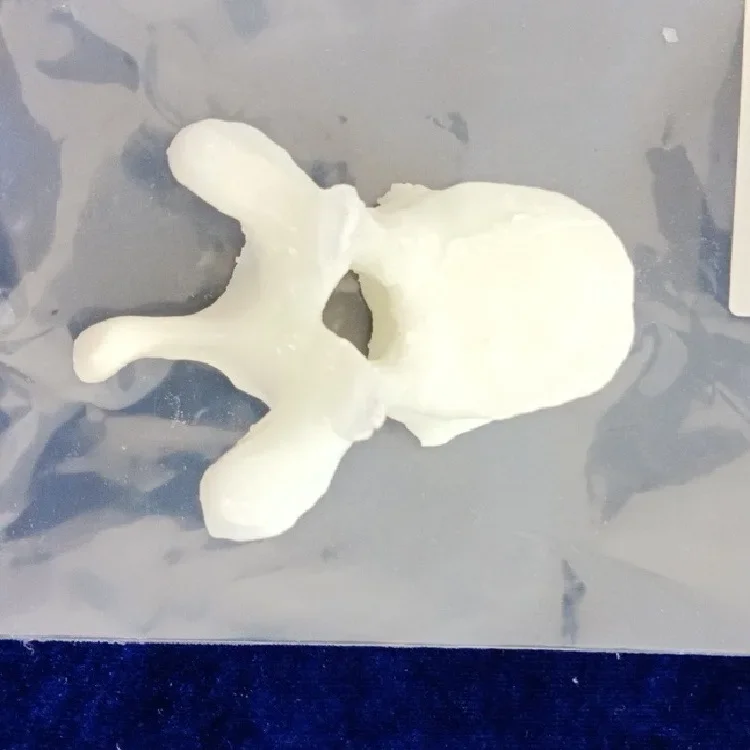 Spinal bone densitometry phantom