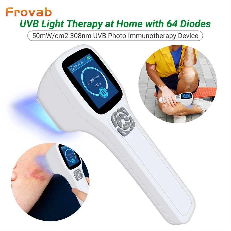 

Frovab 308nm Blue Light Phototherapy Blue Light for Eczema UVB Light Therapy for Vitiligo Cost Excimer Phototherapy Device