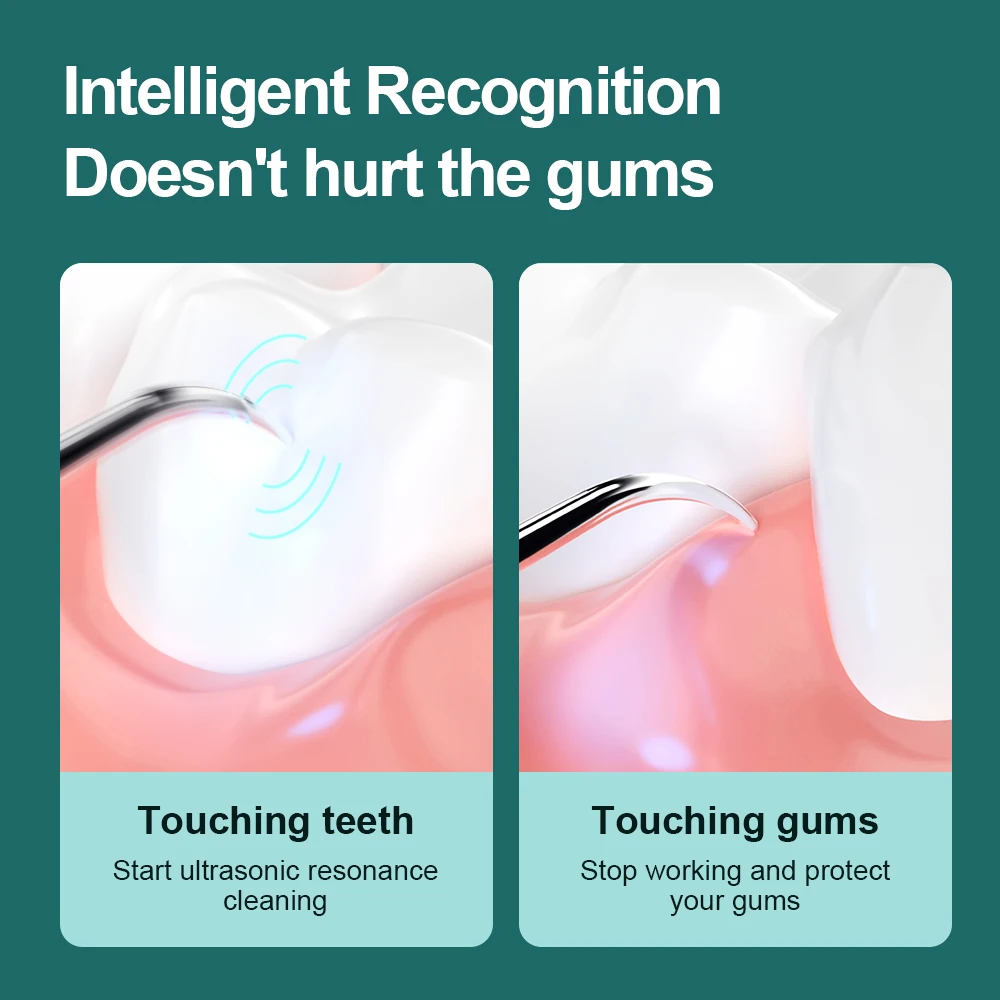 Thumbnail 4 - #9 Compare Ultrasonic Dental Scalers Before You Buy