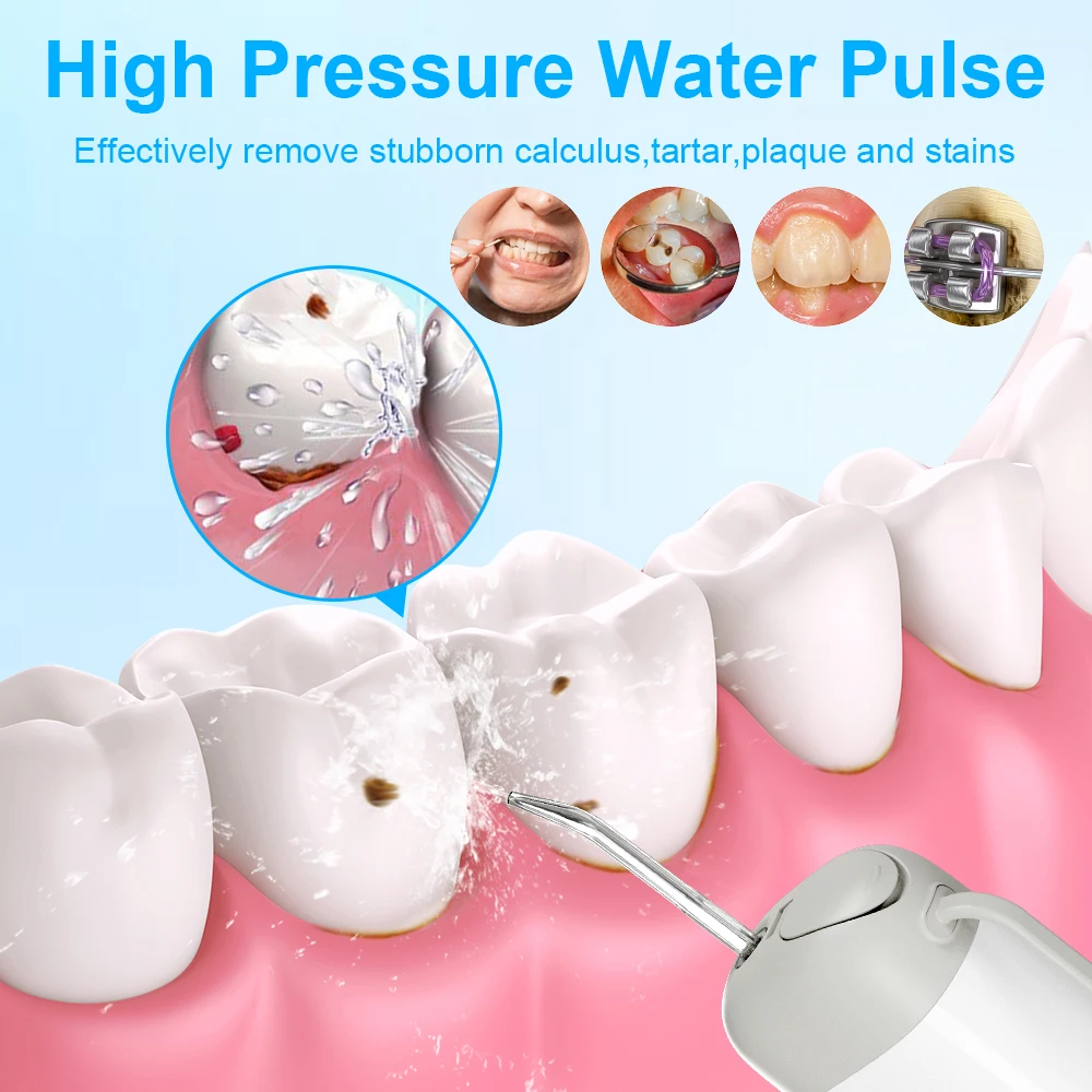 هولماي عن طريق الفم الري المحمولة منظف الأسنان الري القابلة لإعادة الشحن جهاز تنظيف الأسنان بالماء نفاثة مياه للأسنان المياه لتبييض الأسنان