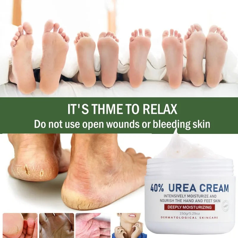 Urine Cream,40% Foot Care Lotion, Suitable for Cracked Heels, Super, Rough, Dry Callused Feet, Soften The Rough Skin on The Feet