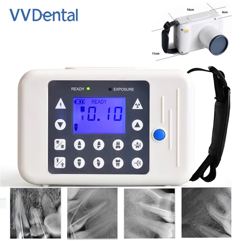 Portable Digital Dental X Ray Machine Free Software Stable Easy Use X Rays Unit Camera Wireless Battery Long Life