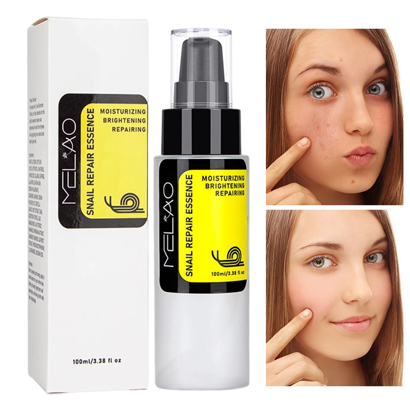 Snail Mucin 96% Power Repairing Essence Lift Firm Anti-aging Fade Fine Lines Acne Facial Sensitive Whitening Brighten