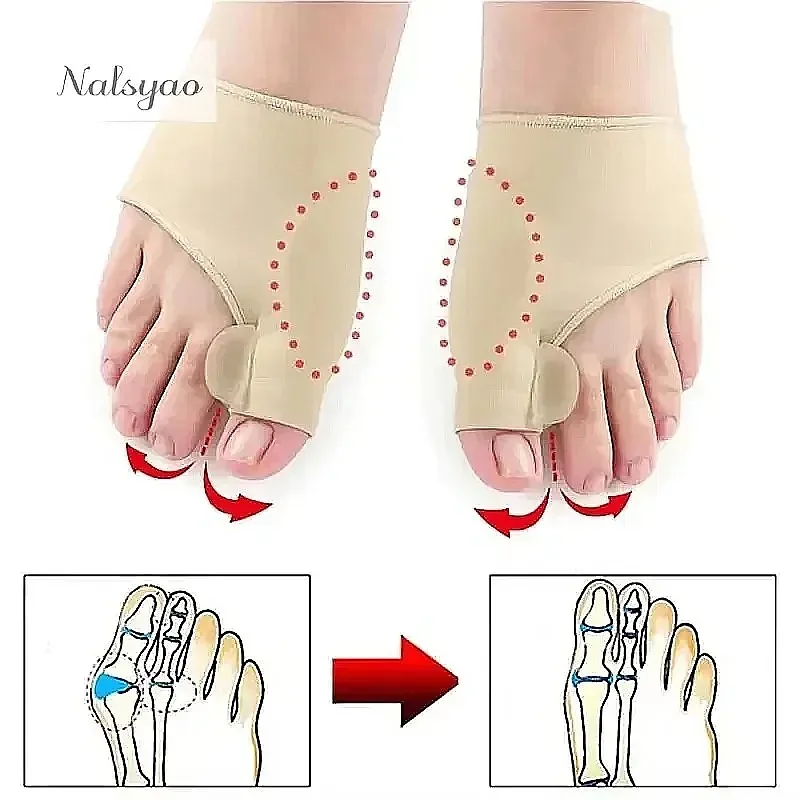 1Pair Orthopedic Toe Separator Hallux Valgus Corrector Hammer Toe Straightener Foot Pain Relief Care Bunion Treatment