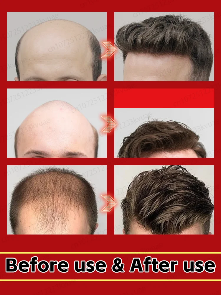 This hair growth product is loved by everyone. It allows you to have flowing hair and say goodbye to hair loss and baldness.