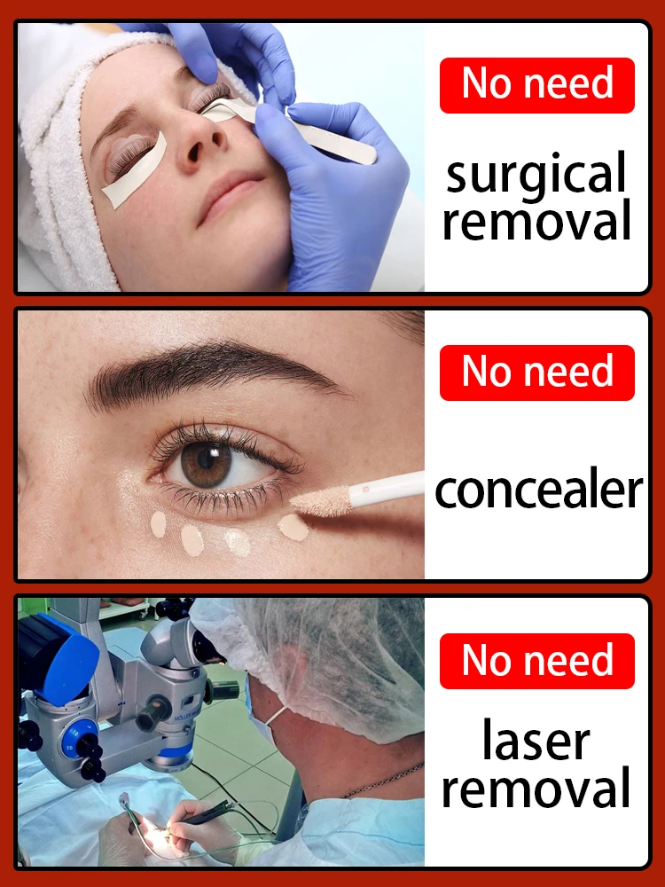 Solving problems around the eye area