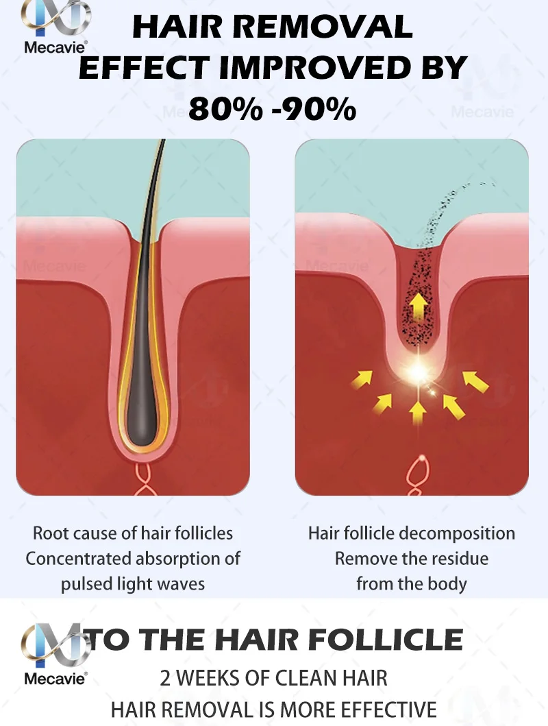 

4000W 2025 NEW 2 IN 1 Soprano Titanium Ice Platinum Diode 755 808 940 1064nm 4 Wavelength Laser Hair Removal Machine Painless