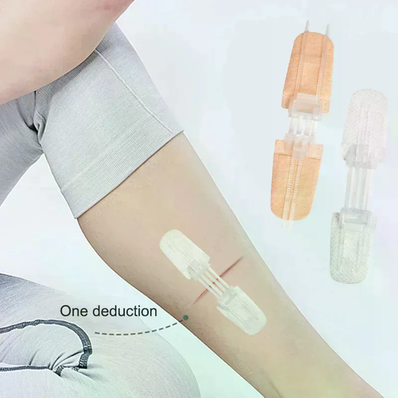Zipper Band Aid Painless Wound Closure Patch Suture Free Medical Adhesive Strip For Rapid Recovery Skin Repair At Home