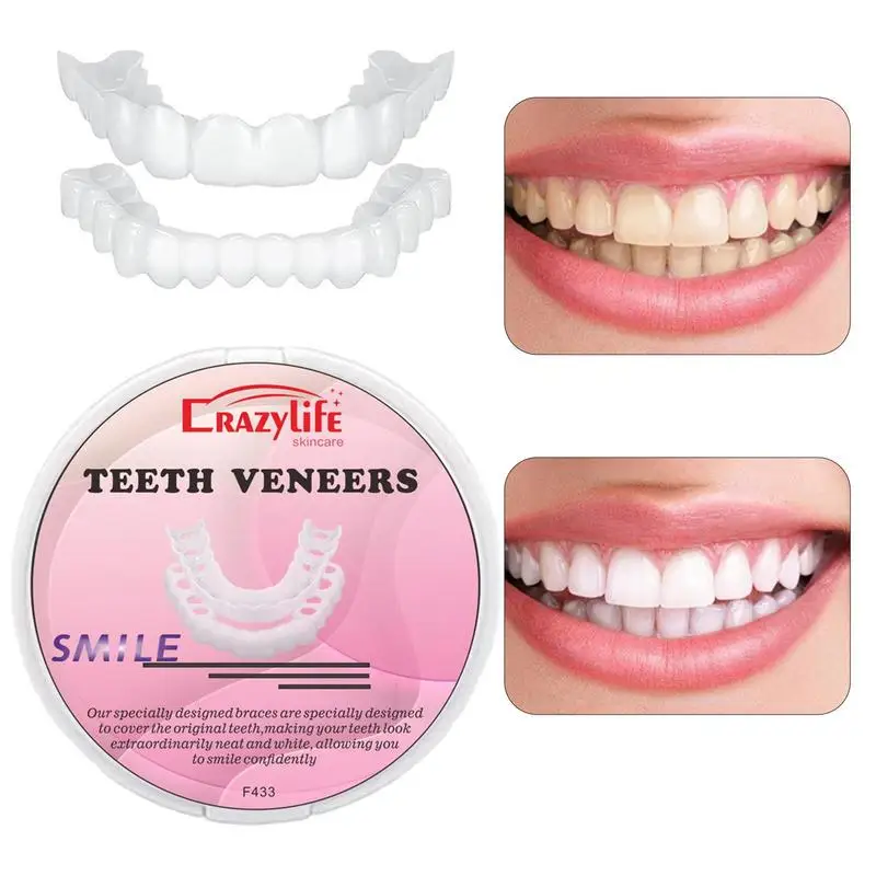 Teeth Veneers Snap on Tooth Cover Set Dentures Dental Veneers Snap on False Teeth Upper & Lower Imitation Teeth Braces Teeth