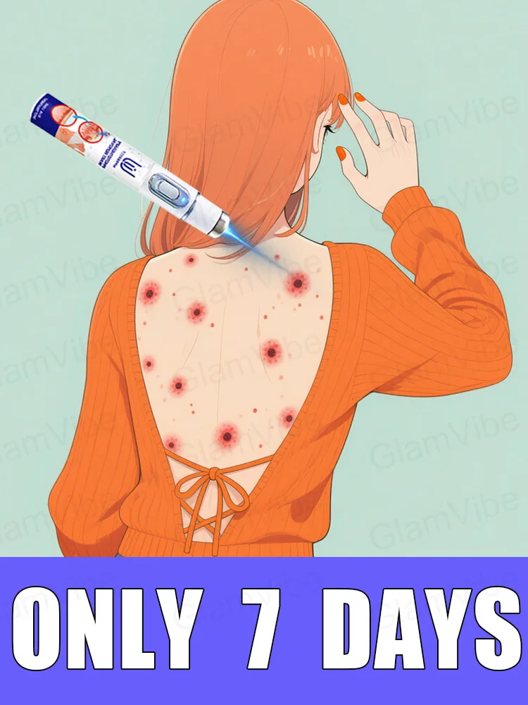 

blue light pen solve warts, hot sale wart care tools