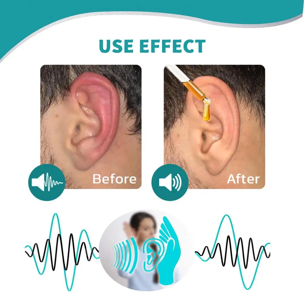 Tinnitus Ear Liquid Non-Pungent Tinnitus Oil Lightweight Herbs Functional Tinnitus Relief Ear Drops