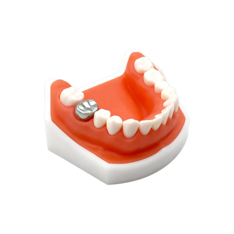 48 pçs/set dental molar dente coroa de aço inoxidável para criança adulto pré-formado coroa de metal fornecimento odontológico