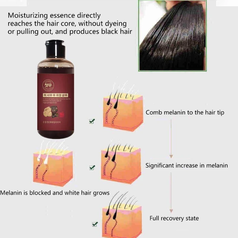 Polygonum Multiflorum – shampoing blanc à à base plantes, efficace, 300ml, livraison directe