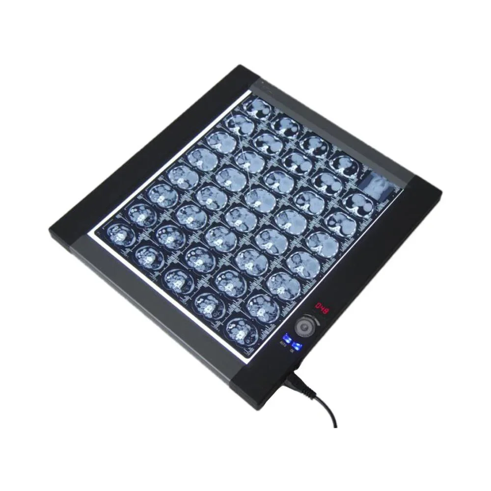 Medical Led X Ray Film Viewer Single X-ray Film Viewing Box New Type Medical X-ray View Box  Negatoscope