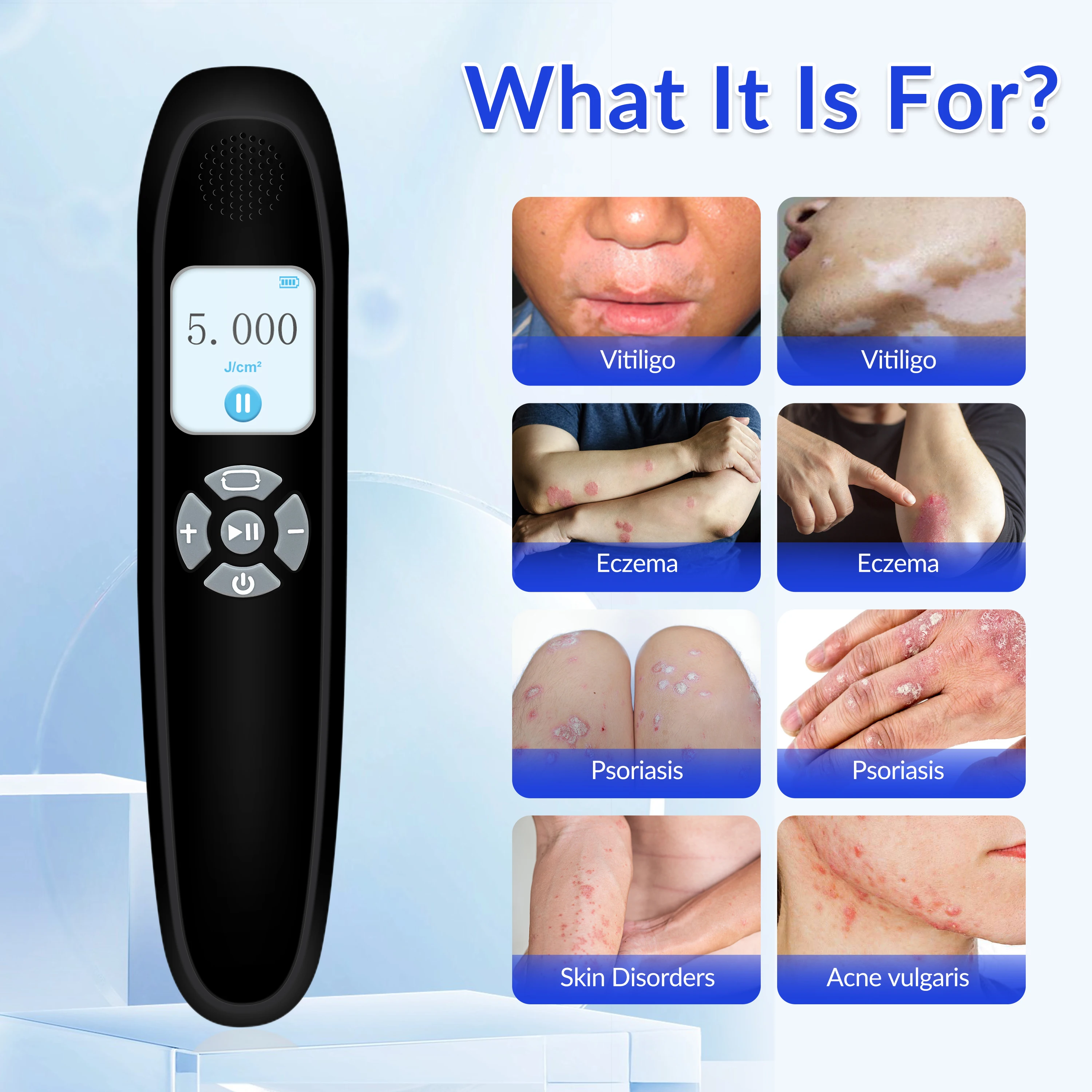 2026 Medical 308 nm Excimer Uvb Light Vitiligo Laser Psoriasis Eczema Tratamiento Treatment Improvements in Skin Conditions
