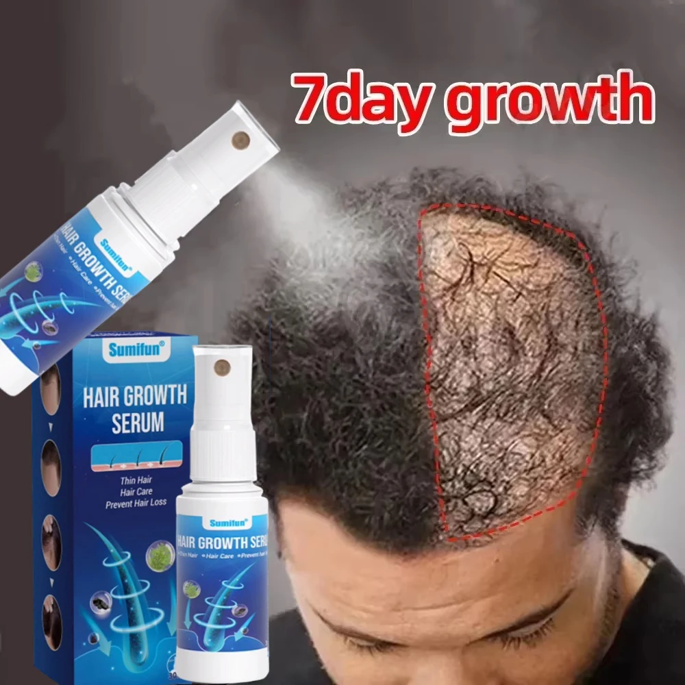 

Спрей-сыворотка для быстрого роста волос, против выпадения волос, предотвращает облысение, лечит кожу головы, восстанавливает корни, уход за волосами для мужчин и женщин.