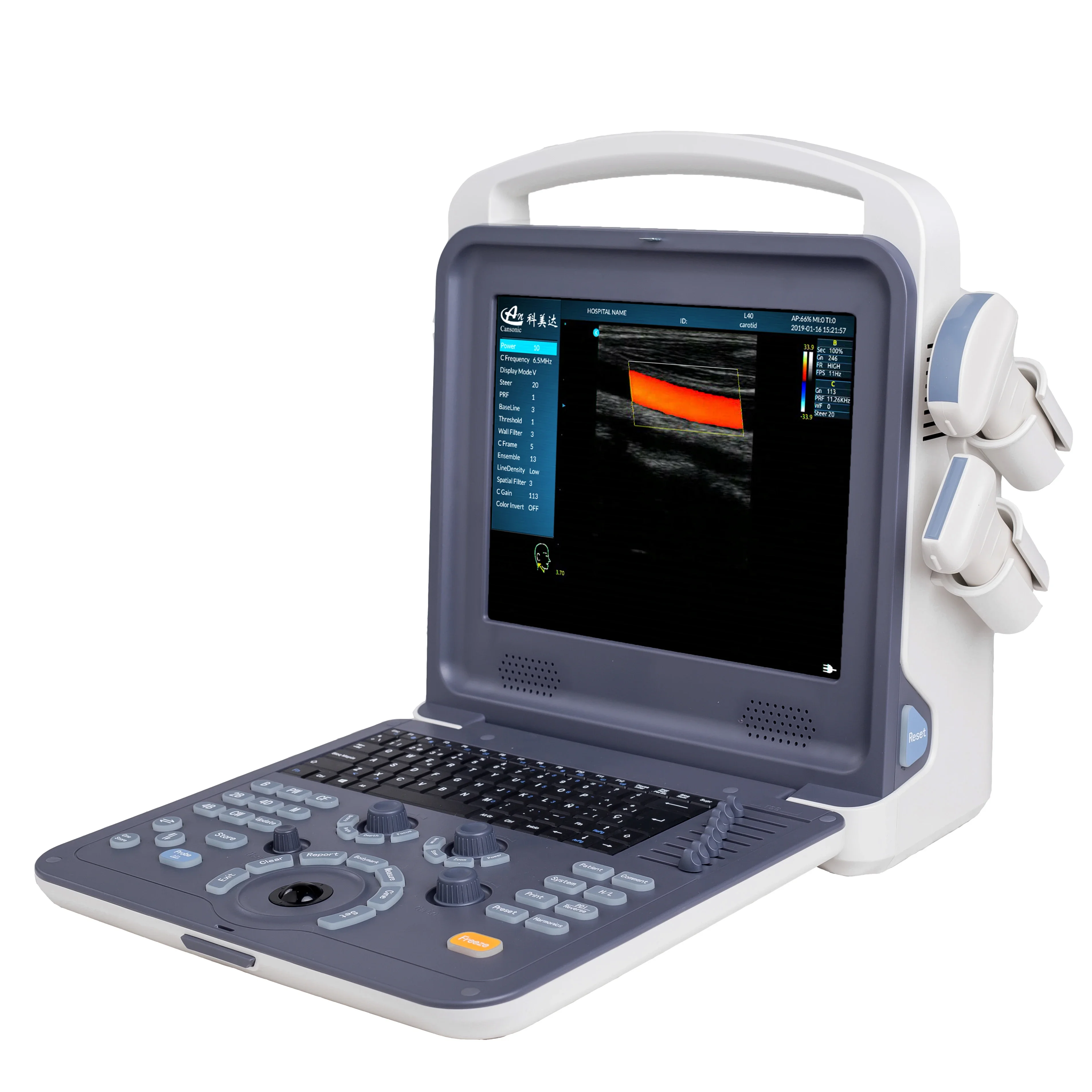 China Cheapest Medical Portable Full Digital Color Doppler B Ultrasound Scanner/scan/machine Price For  With Probe