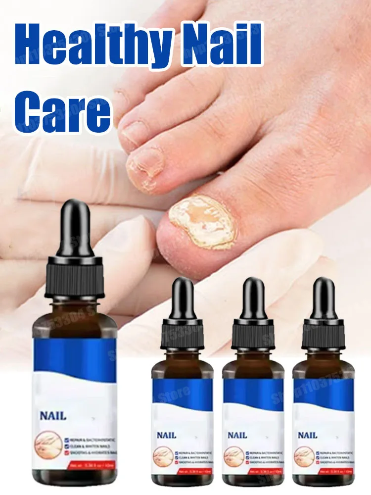 Foot Nail Essential Oil