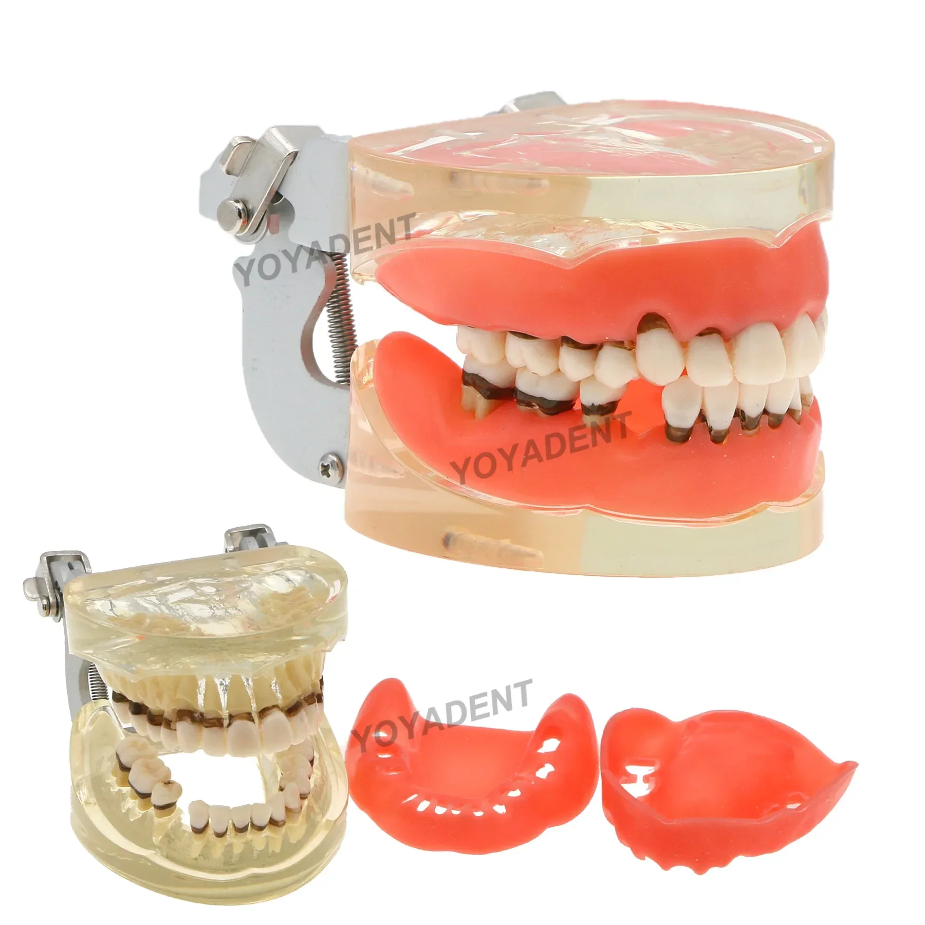 

Dental Teeth Model Dentistry Periodontal Disease Pathological Teaching Models For Patient Education Demo Resins Model M4017