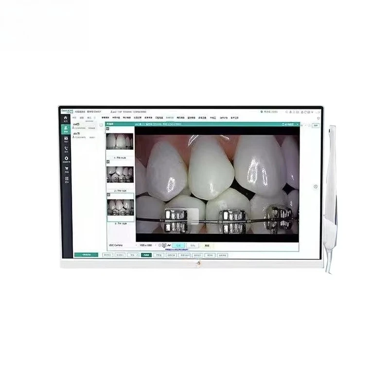 17 24 Inch HD Digital Oral Camera WIFI Dental Intraoral Camera All in One Computer Intraoral Camera with Bracket Holder
