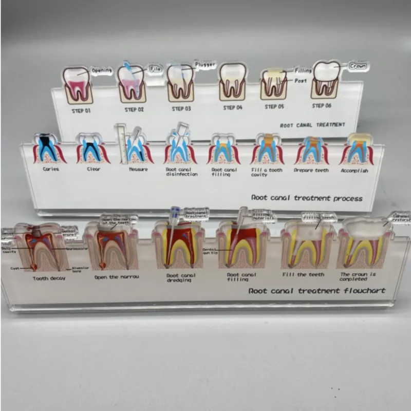 Dental Root Canal Treatment Flowchart Stand for Dental Laboratories Dentist Study Dental Teaching Model Dentist Gift Dentistry