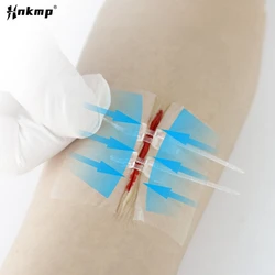 1/2Pcs Zipper Tie Wound Closure Patch Hemostatic Patch Wound Fast Suture Zipper Band-Aid Outdoor Portable