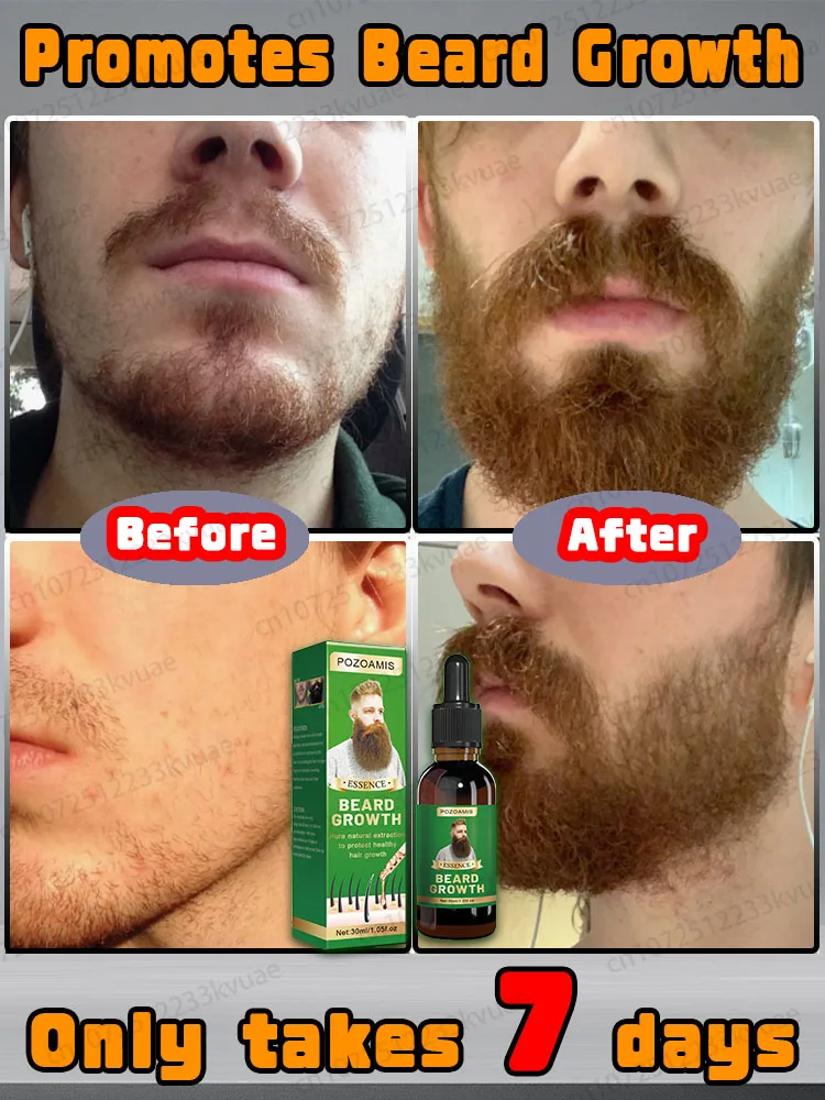 Men's Choice Beard Growth Essence,quickly grows a thick beard, saysgoodbye to sparse beards, and creates acharming beard