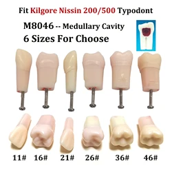 5Pcs Kilgore Nissin 200 / 500 Type Dental Practice Screw-in Teeth Model Typodont Endodontic Root Canal Pulp Cavity Medullary RCT