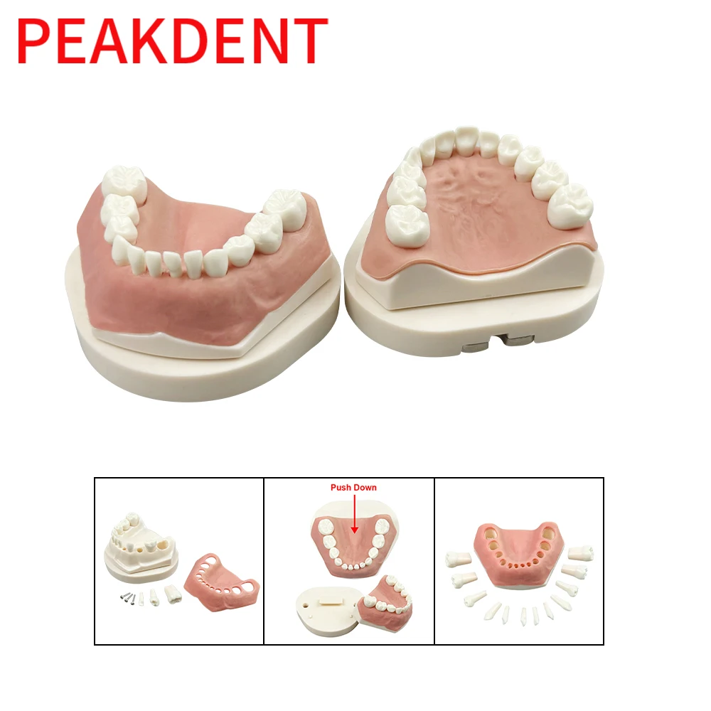 24 Teeth Kids Dental Practice Teeth Model With Removable Deciduous Tooth For Dental Education Demo Pratice Product