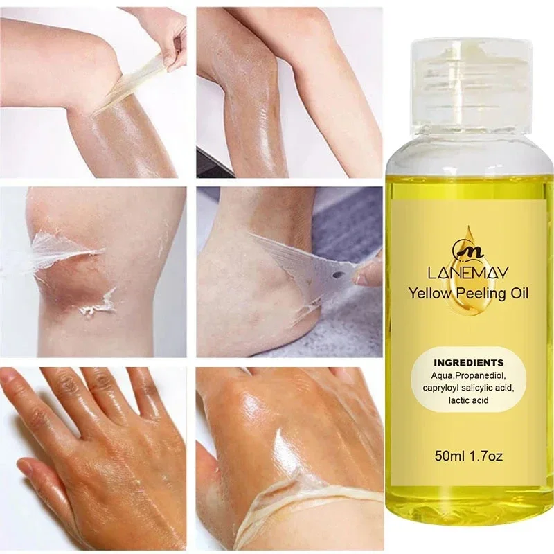 Body Care Exfoliating Yellow Peeling Oil 100% Organic Bleaching Dark Skin Serum Dark Knuckles Fast Whitening Cosmetics