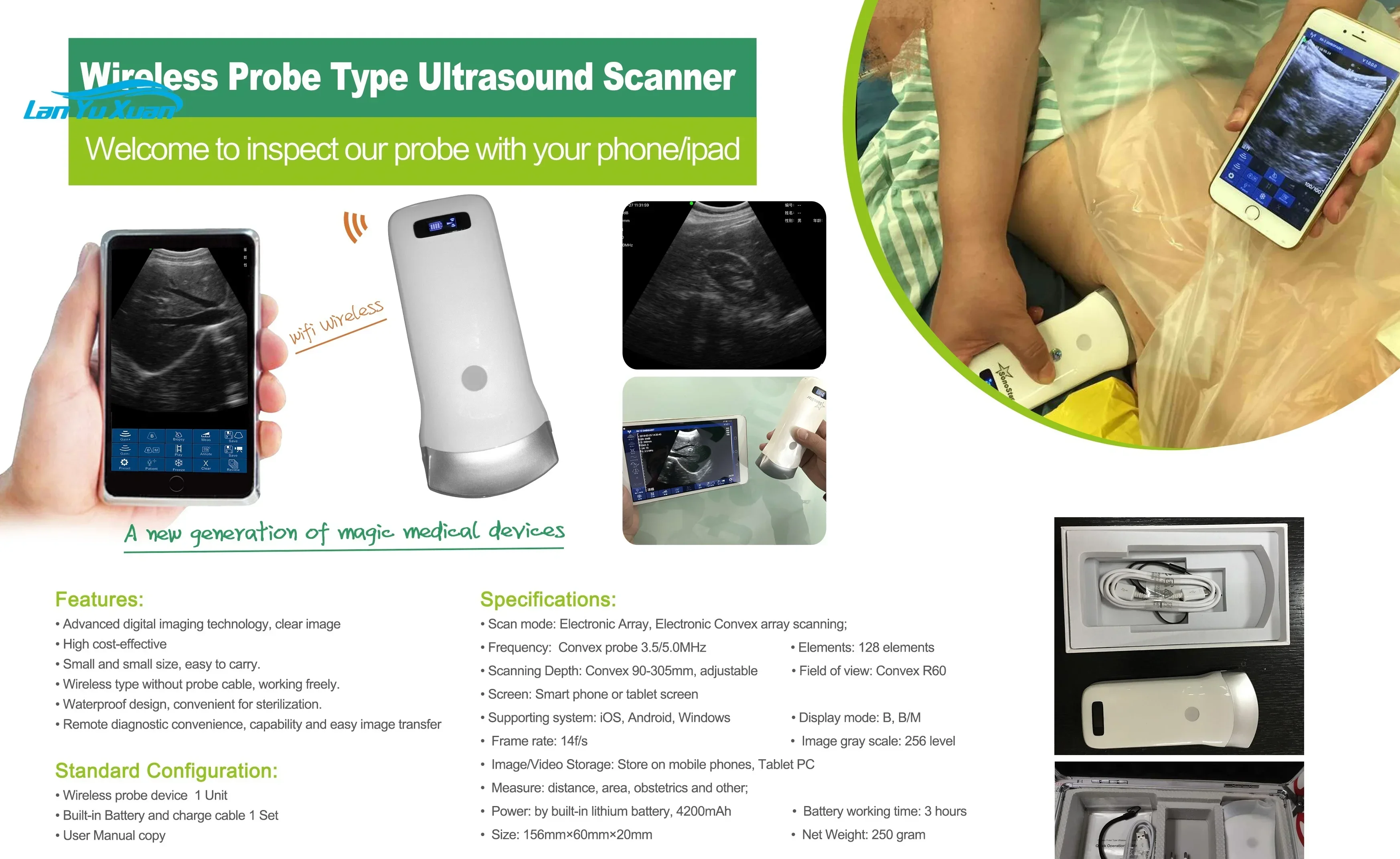 Medical B Type Doppler Ultrasound Scanner Wifi Wireless Probe Convex Portable Ultrasonic Machine