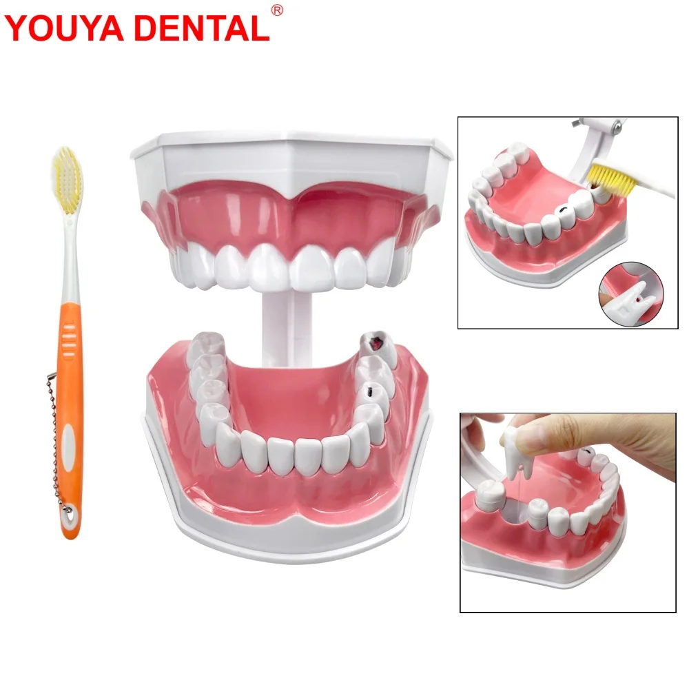 Dental Caries Model Plastic Teeth Model With Toothbrush Removable Dental Model Teeth Brushing Model For Studying Teaching Demo