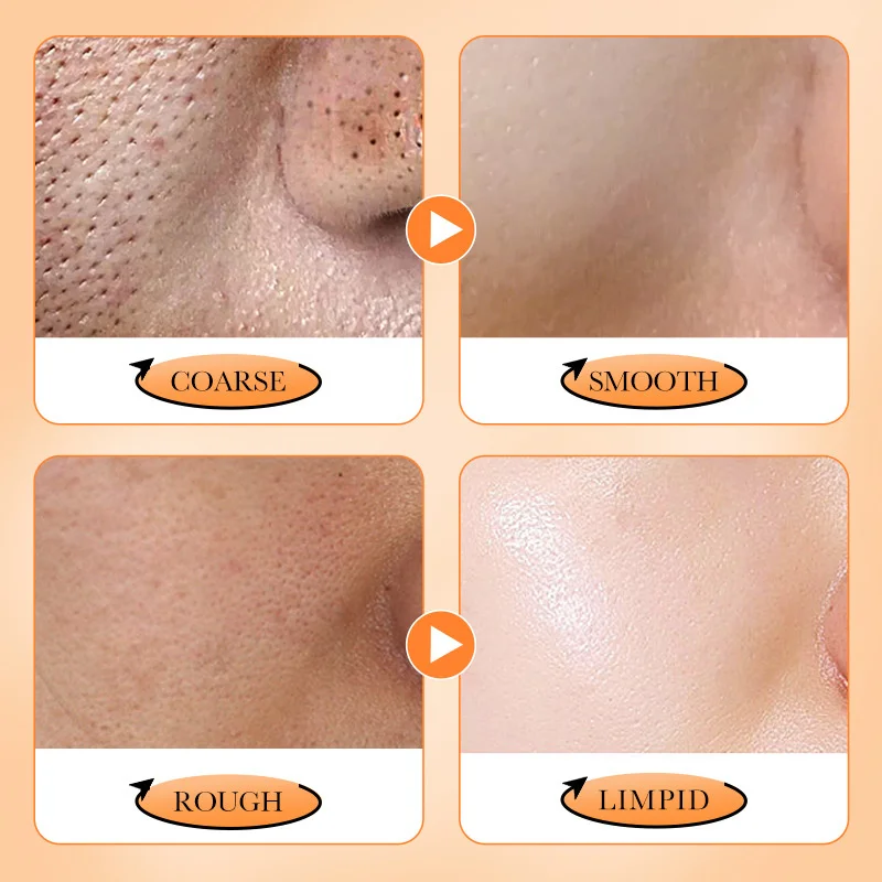 Exfoliant hydratant élimine la peau terne, augmente l'hydratation et répare la barrière cutanée