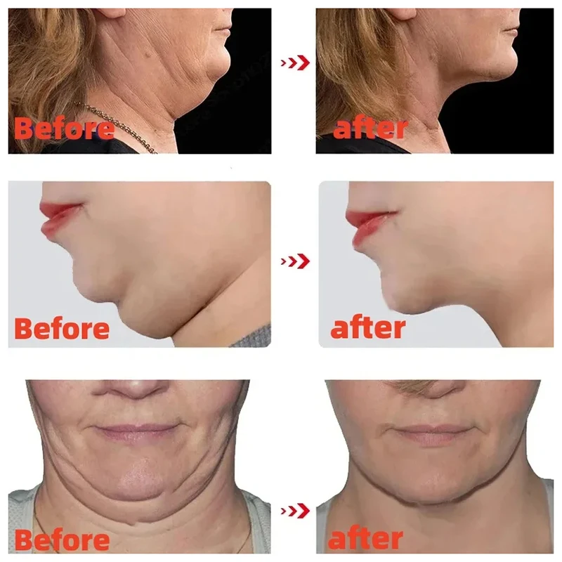 V Face Slimming Cream Enzyme Massage Cream Firming Face Lift To Remove Masseter Double Chin To Lighten Neck Line Slimming Cream