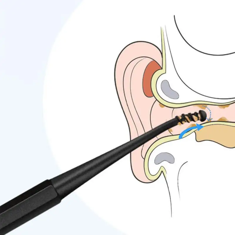 Mintiml NeWorld-Cure-oreille rotatif à double tête, résistant à 360, spirale souple, outil de nettoyage rapide, 4 pièces