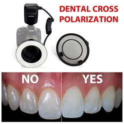 Camera Dental Photography - No Reflection Cross Polarization Set For Godox MF-R76 Flashes. Ring Flashes Intraoral Photography