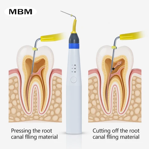 Bolígrafo calefactor de gutapercha Dental MBM con 2 puntas enchufables, bolígrafo inalámbrico para obturación Endo de guta, herramienta de calefacción para terapia de conducto radicular