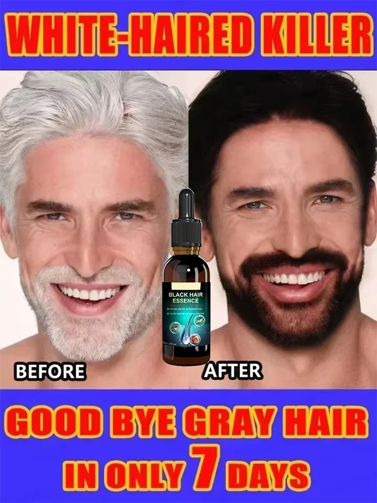 

White Hair Care White hairs essence Natural Anti Gray Hairs Serum - Repair White & Darkening Hair| Nourishing Hair Care Remedy